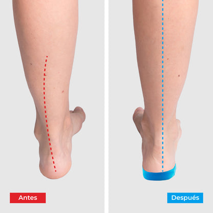 ComfyFeet Pro™ – Plantillas Ortopédicas de Alivio Total para Pies Cansados