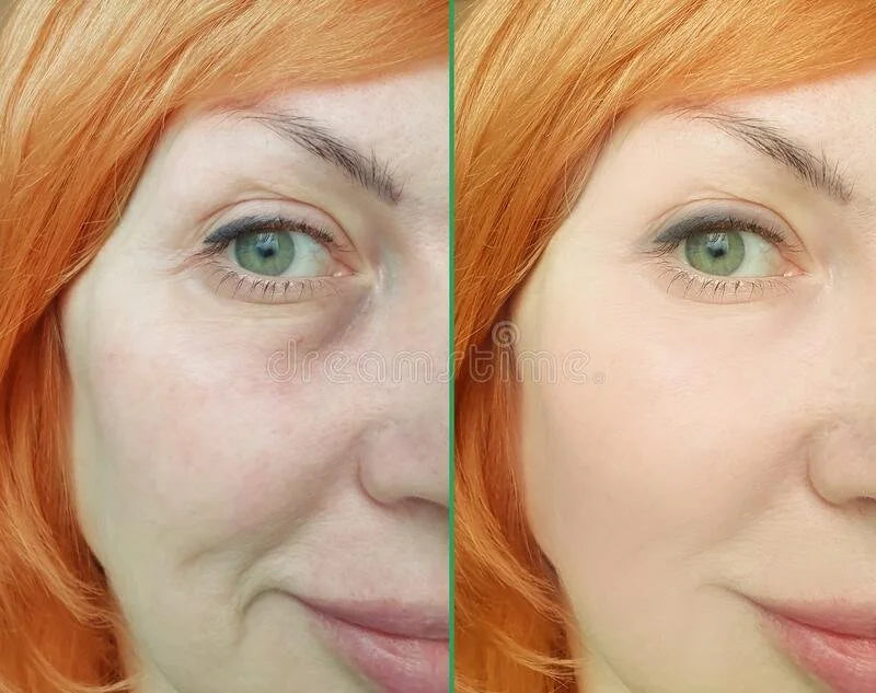 Crema Antiarrugas