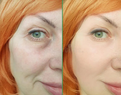 Crema Antiarrugas